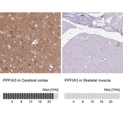 PPFIA3 Antibody, Novus Biologicals 25 &mu;L, Unlabeled:Antibodies, Polyclonal